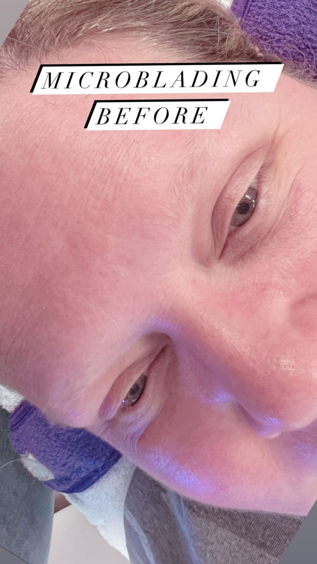 Corrective microblading result