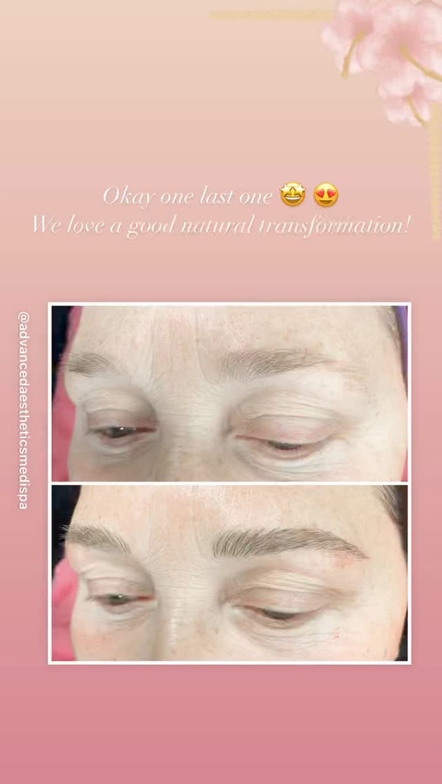Natural transformation microblading before and after
