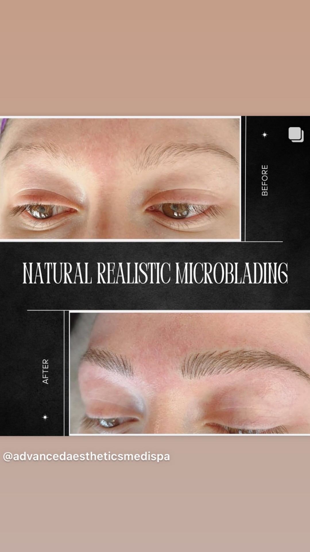 Defined, fuller brows after microblading