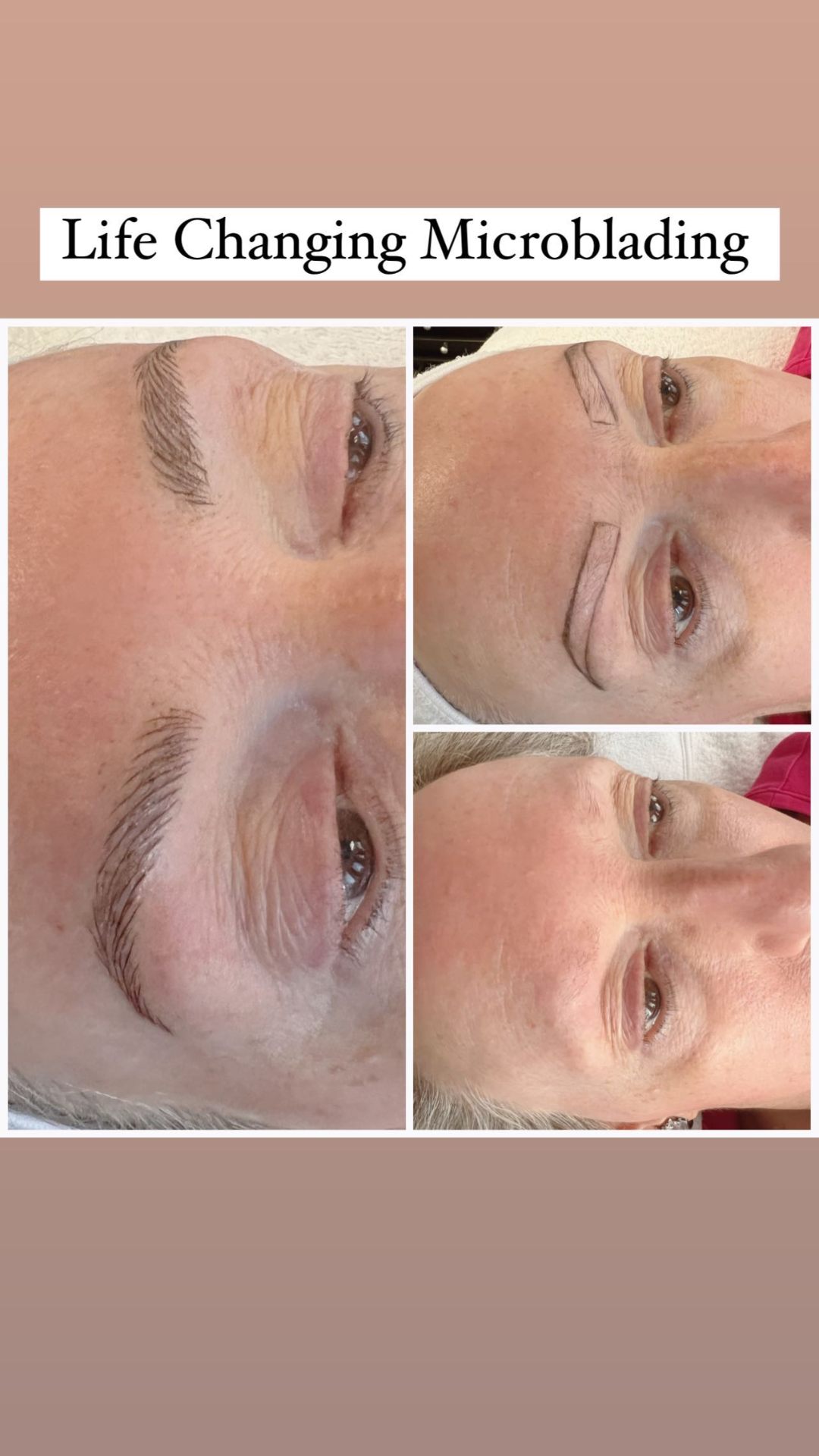 Life-changing microblading before and after