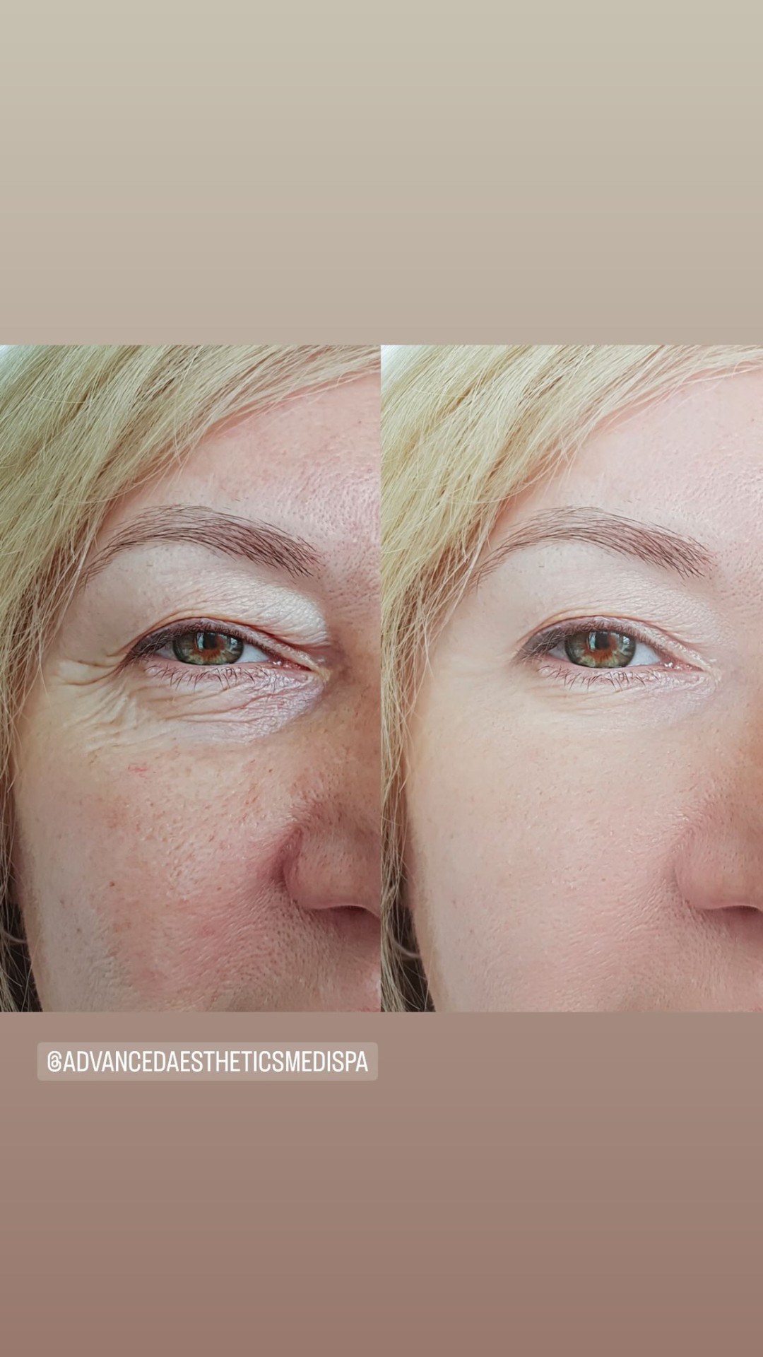 Natural realistic microblading result by Lana