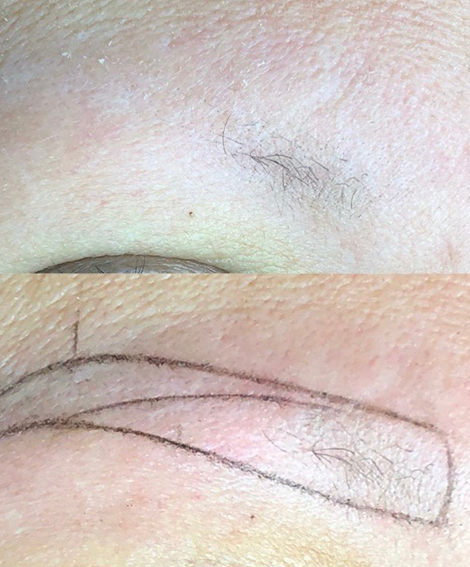 Sparse brow before treatment with drawn shape mapping